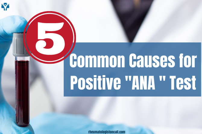 Positive ANA -What are the common 5 causes for a positive ANA test ?