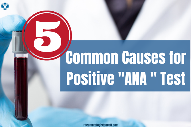 Positive ANA Know Common 5 Causes For A Positive ANA Test