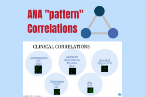 ANA Pattern and Clinical Correlation with Autoimmune Diseases