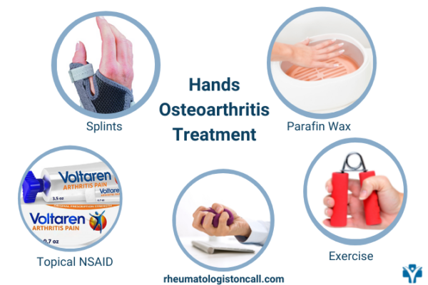 How To Treat Hand Osteoarthritis At Home Rheumatologist Oncall Inflammatory Arthritis 6636