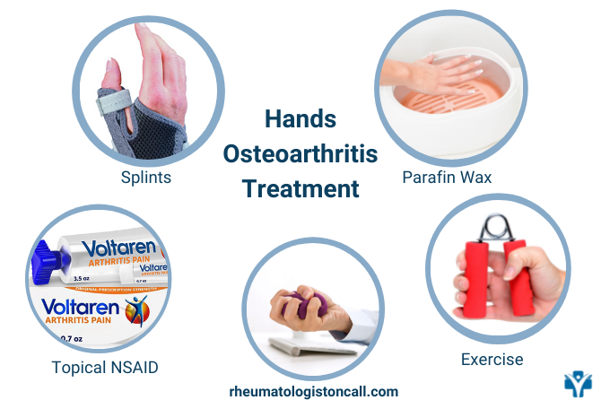 How To Treat Hand Osteoarthritis At Home? - Rheumatologist OnCall ...