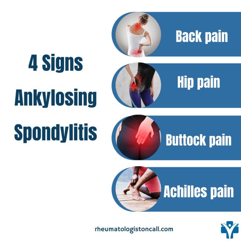 Five Exercises to move Better with Ankylosing Spondylitis