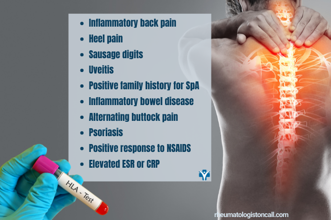 Ankylosing Spondylitis -Is HLA-B27 Essential For Diagnosis?