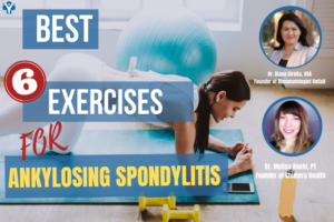 Best Exercises For Ankylosing Spondylitis At Home - Rheumatologist ...