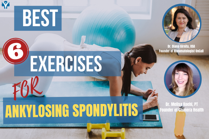 Best Exercises For Ankylosing Spondylitis -That You Can Practice at Home