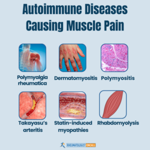 What autoimmune diseases cause muscle pain