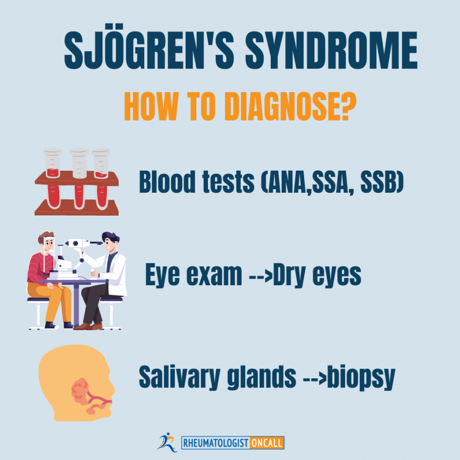 Sjogren's Syndrome A Complex Autoimmune Disease » Rheumatologist OnCall