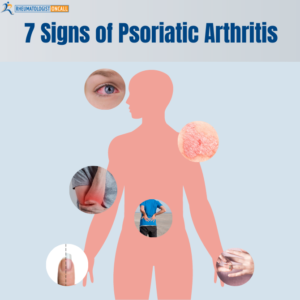 Psoriatic Arthritis - Why Diagnosis Can Be Challenging