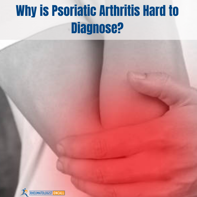common signs of psoriatic arthritis