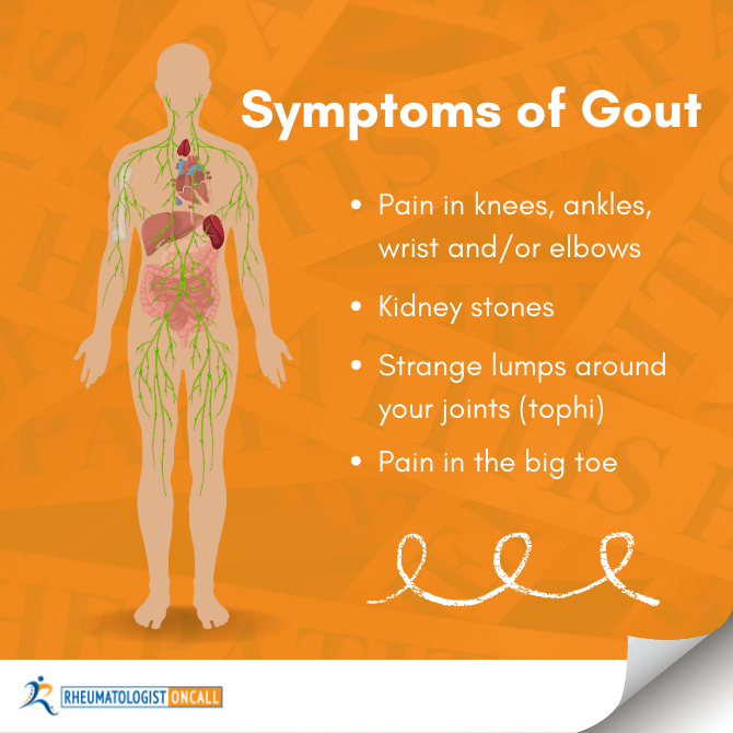 5 Warning Signs & Symptoms Of Gout | In-Depth Examination