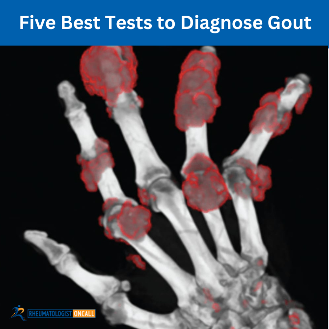5 tests for gout
