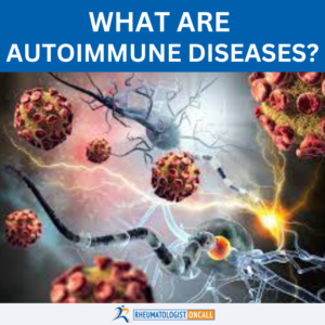 common autoimmune diseases