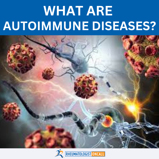 10 Most Common Autoimmune Diseases | Rheumatologist Guide