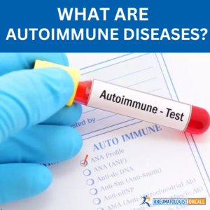 autoimmune disease test