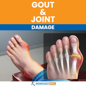 Gout and Joint Damage