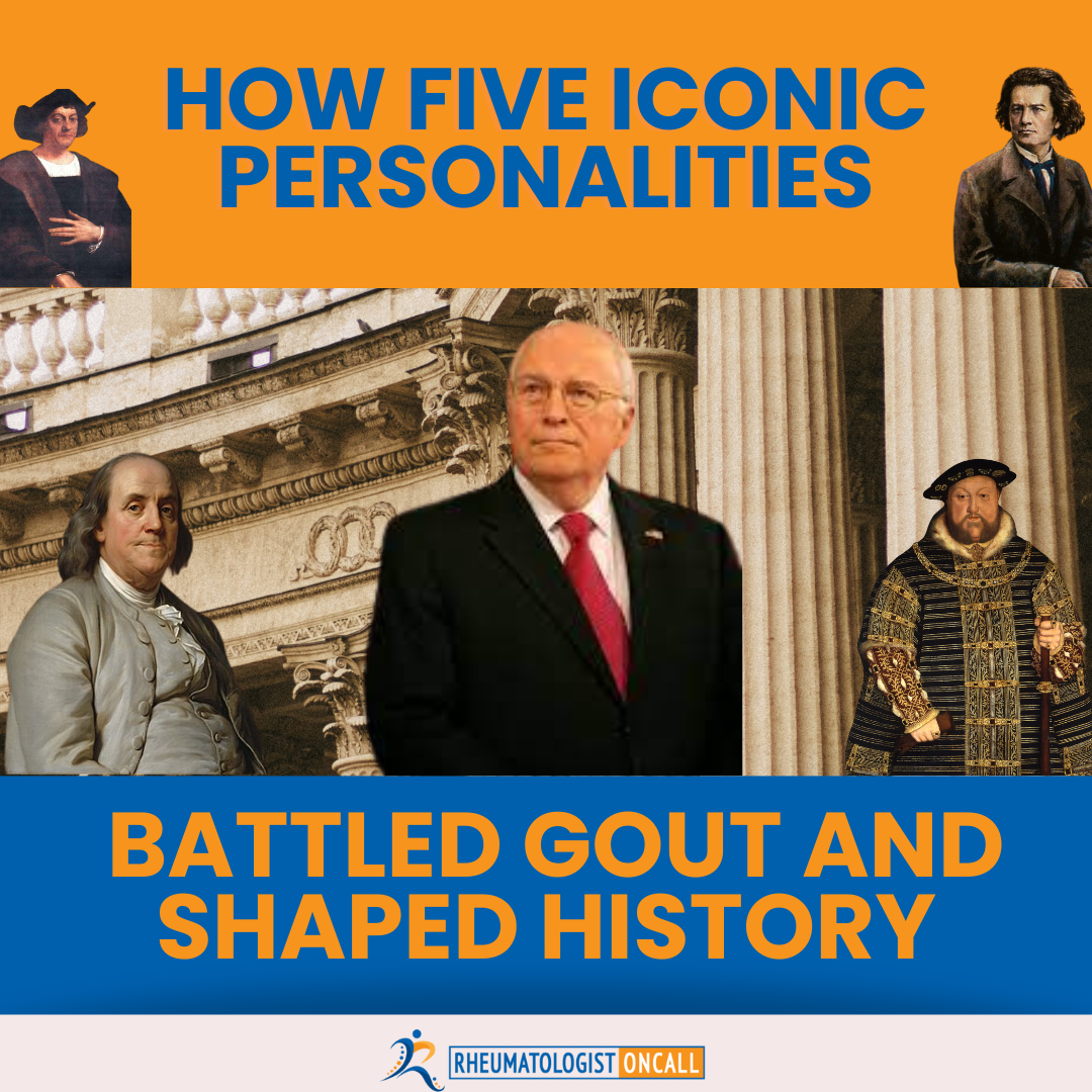 5 Iconic Personalities Battled Gout
