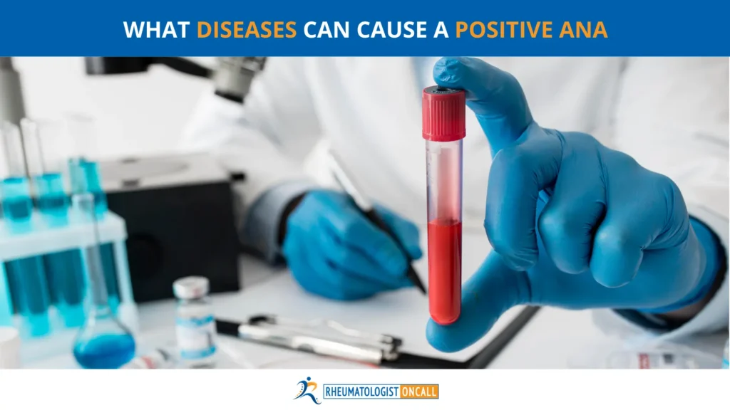 Blog image for https://rheumatologistoncall.com/2023/08/16/what-diseases-can-cause-a-positive-ana/