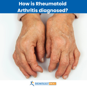 rheumatoid arthritis with negative rheumatoid factor
