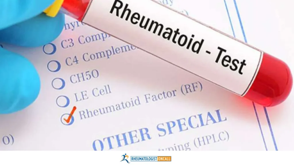 rheumatoid arthritis blood test results