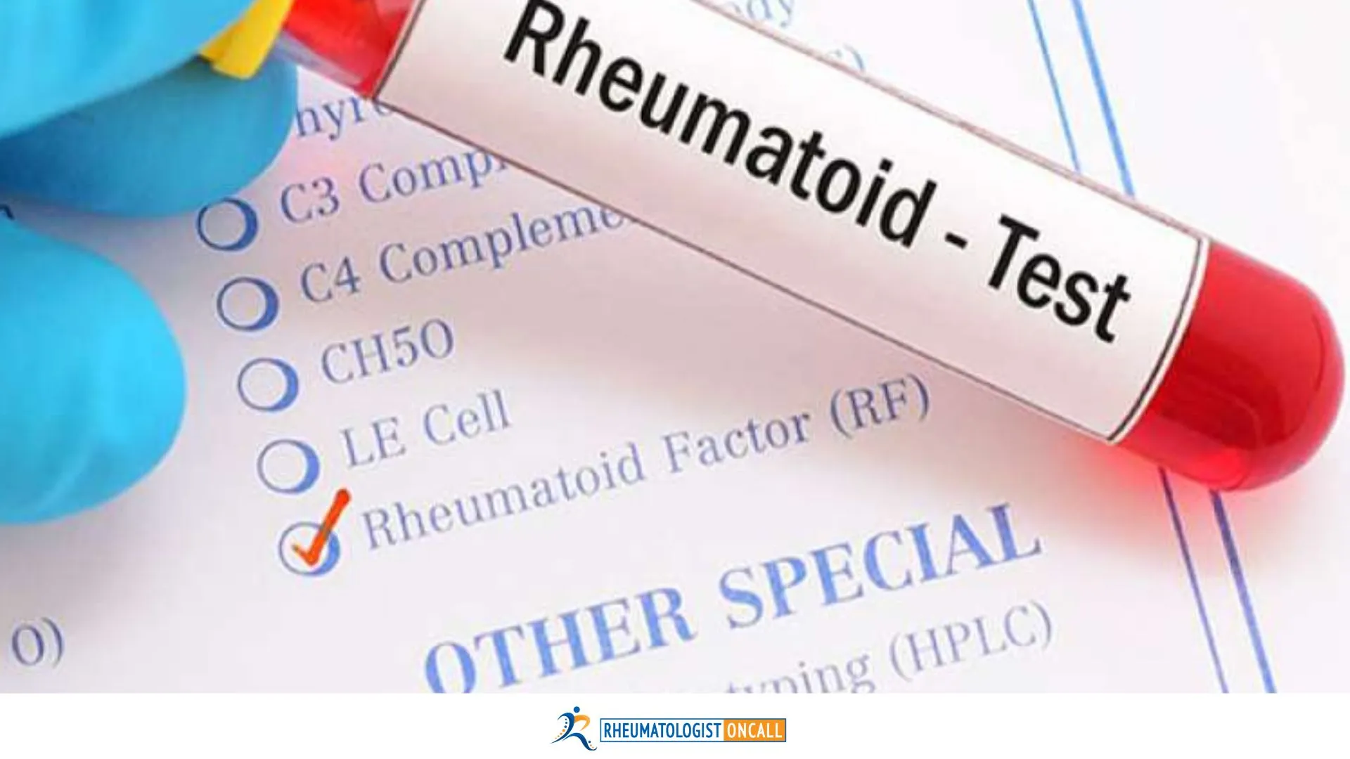 rheumatoid arthritis blood test results