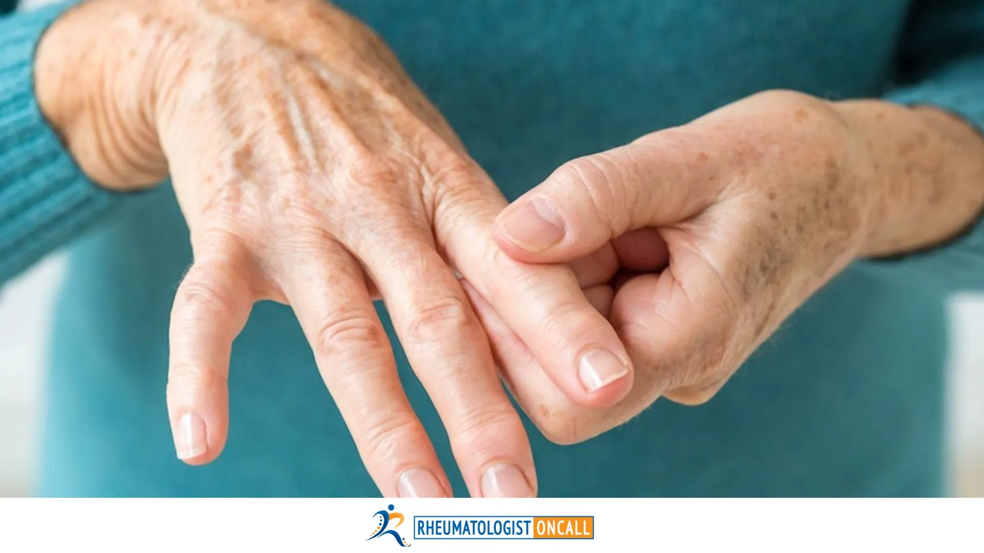 rheumatoid arthritis and sjogren's disease