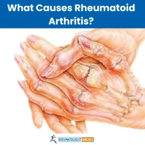 rheumatoid arthritis cure