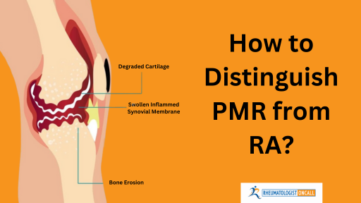 how-to-distinguish-pmr-from-ra