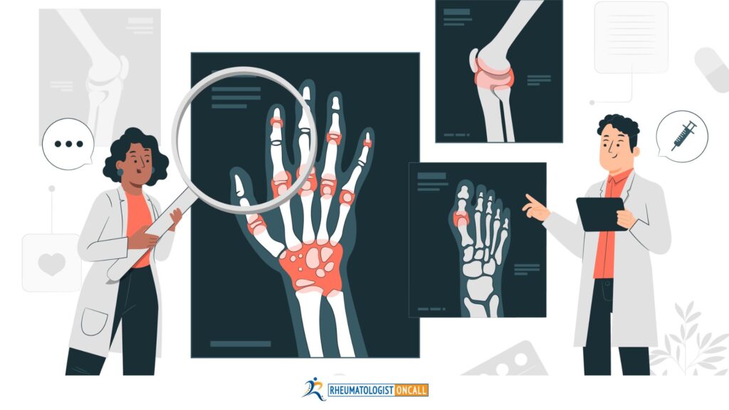 5 common rheumatoid arthritis myths