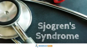 Sjogren's Syndrome