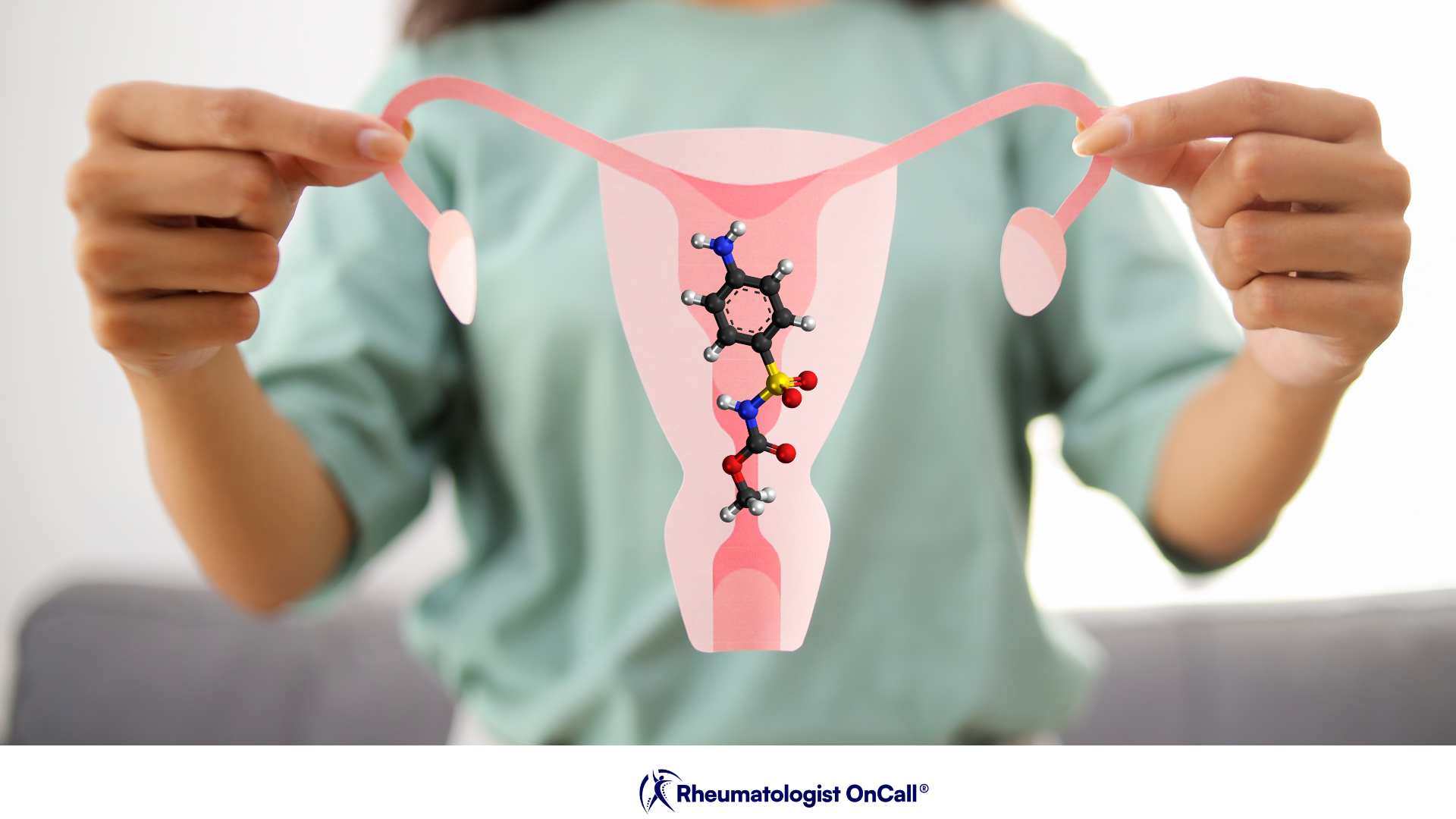 Use Vaginal Estrogen for Autoimmune Women