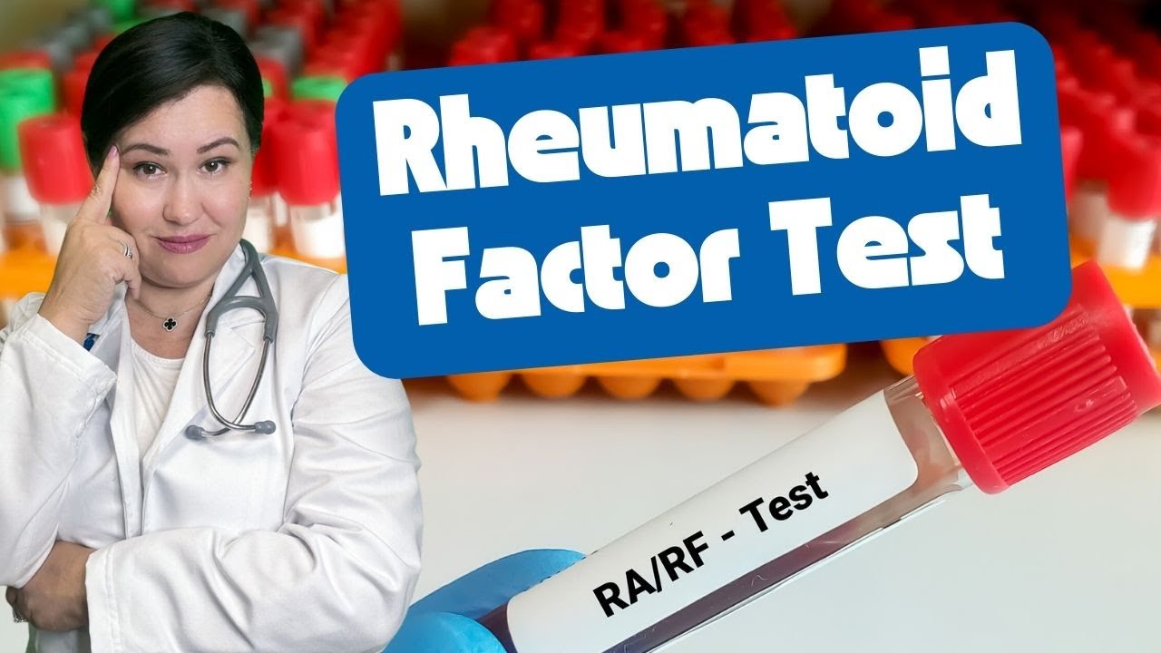 What are the Rheumatoid Arthritis blood tests Results